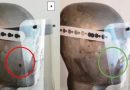 Coronavirus: A4-sized face shields ‘too narrow’ for PPE