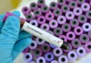 Testing for new coronavirus strain ongoing – GHS