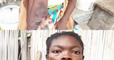 Keta: Lady with rotten arm cries for help